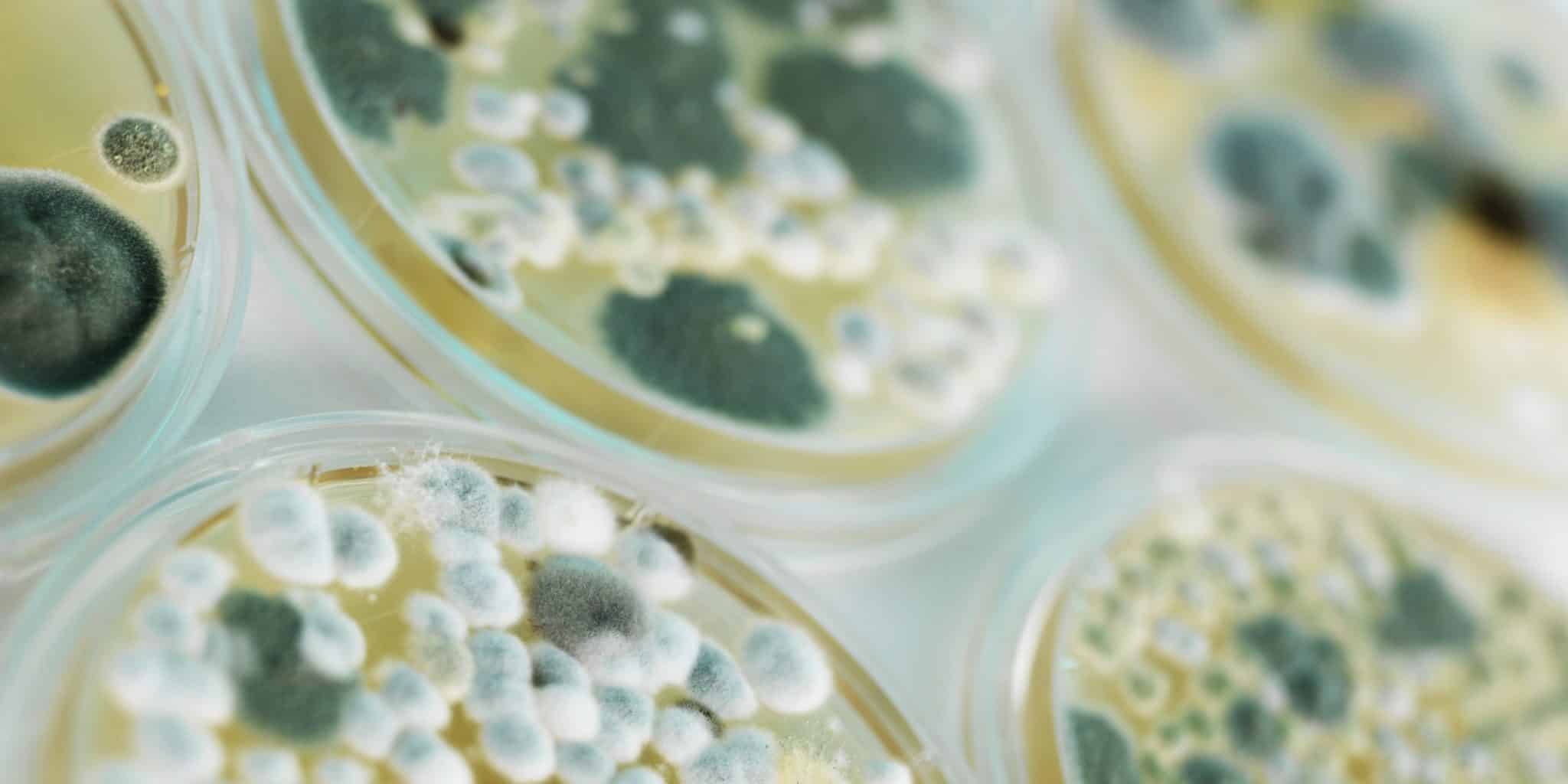Bilder av Muggsopp MicroBio